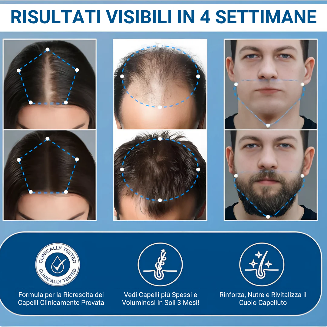 Siero roll-on per la crescita avanzata dei capelli